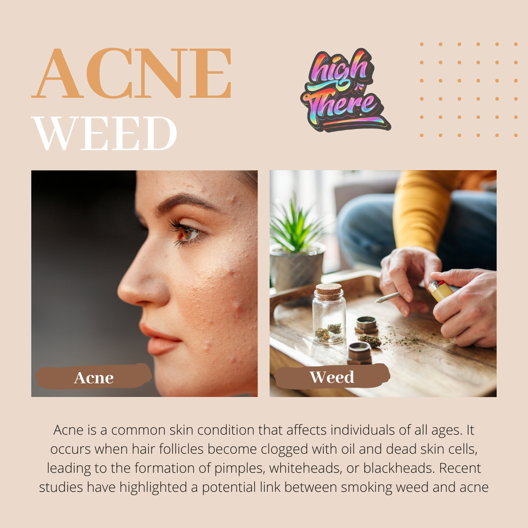 Acne Weed